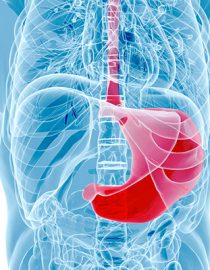 The Link Between Diabetes and Gastroparesis The Link Between Diabetes and Gastroparesis